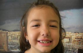 Traitement d'orthodontie sans extractions de dents définitives Voir(onglet actif)