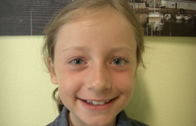 Traitement d'orthodontie d'une enfant de 9 Ans