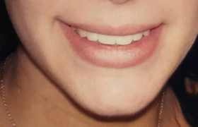 orthodontie