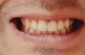 orthodontie