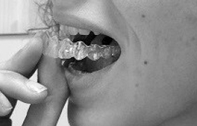 orthodontie