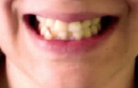 orthodontie