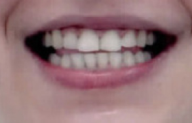 orthodontie