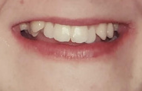 orthodontie