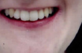 orthodontie